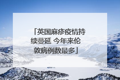 英国麻疹疫情持续蔓延 今年来伦敦病例数最多