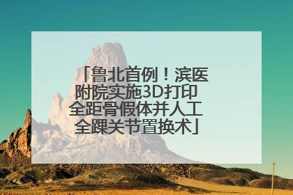 鲁北首例！滨医附院实施3D打印全距骨假体并人工全踝关节置换术